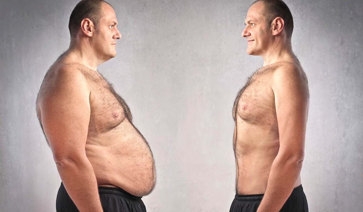 42 metų vyras negali numesti svorio